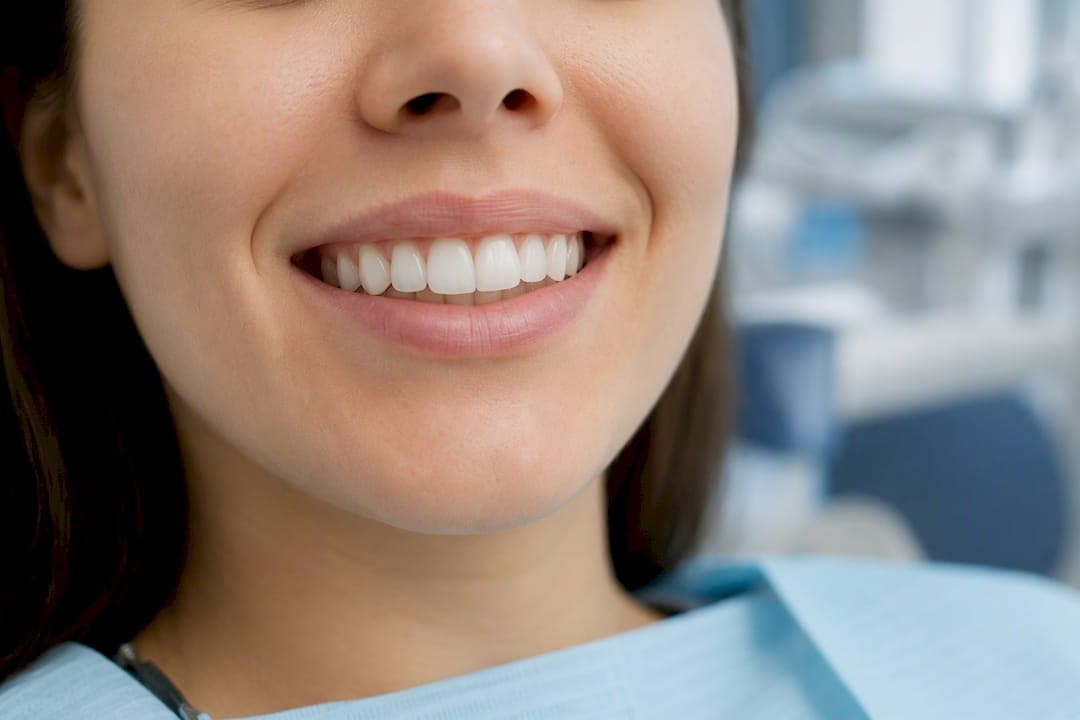 Implant dentar în București: ghid practic pentru pacienți