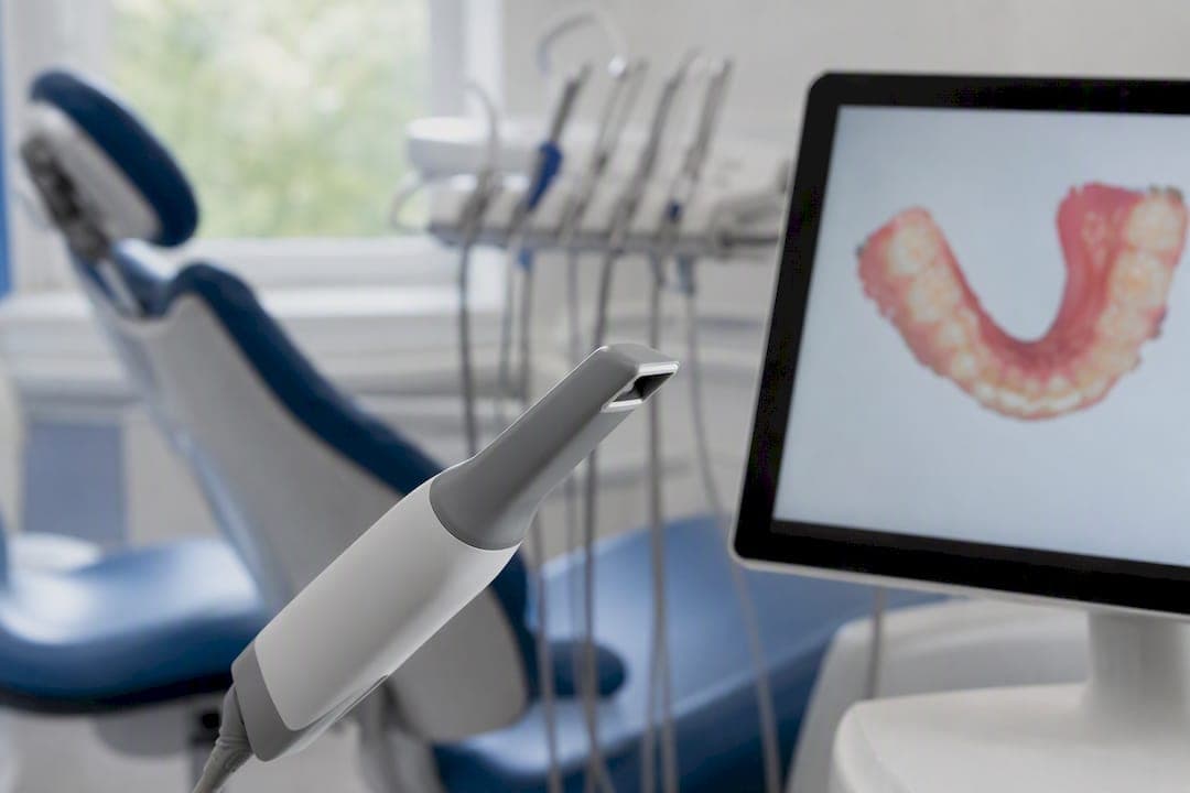 Scanarea intraorală: cum funcţionează amprenta digitală 3D