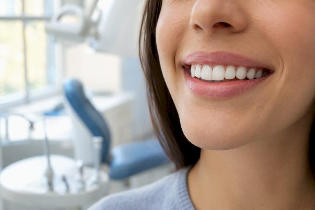 Chiuretajul subgingival: ce este, când e necesar și ce urmează