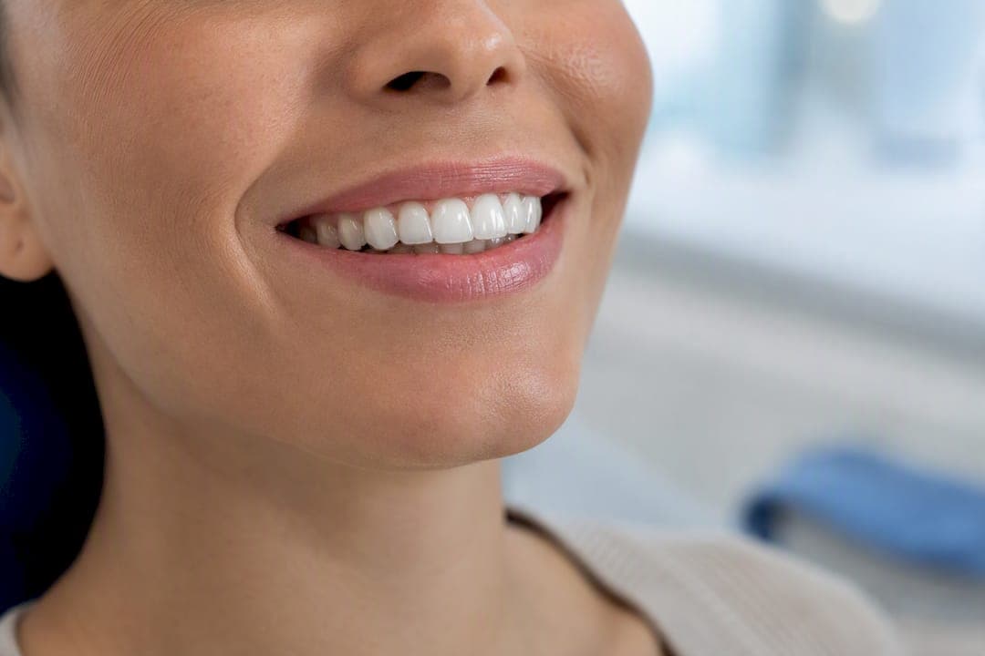 Pacienți: gutieră pentru bruxism cu dovezi clinice și pași practici