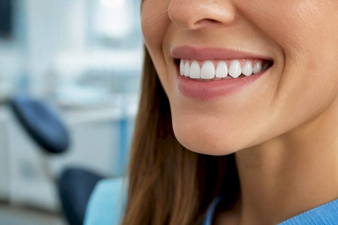 Sub o oră, ce să aștepți la o grefă gingivală: pași și recuperare